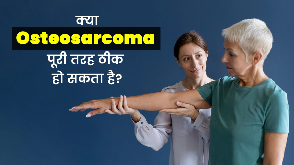 Osteosarcoma Bone Cancer: क्या ओस्टियोसारकोमा (हड्डी का कैंसर) पूरी तरह ठीक हो सकता है? डॉक्टर से जानें सच्चाई