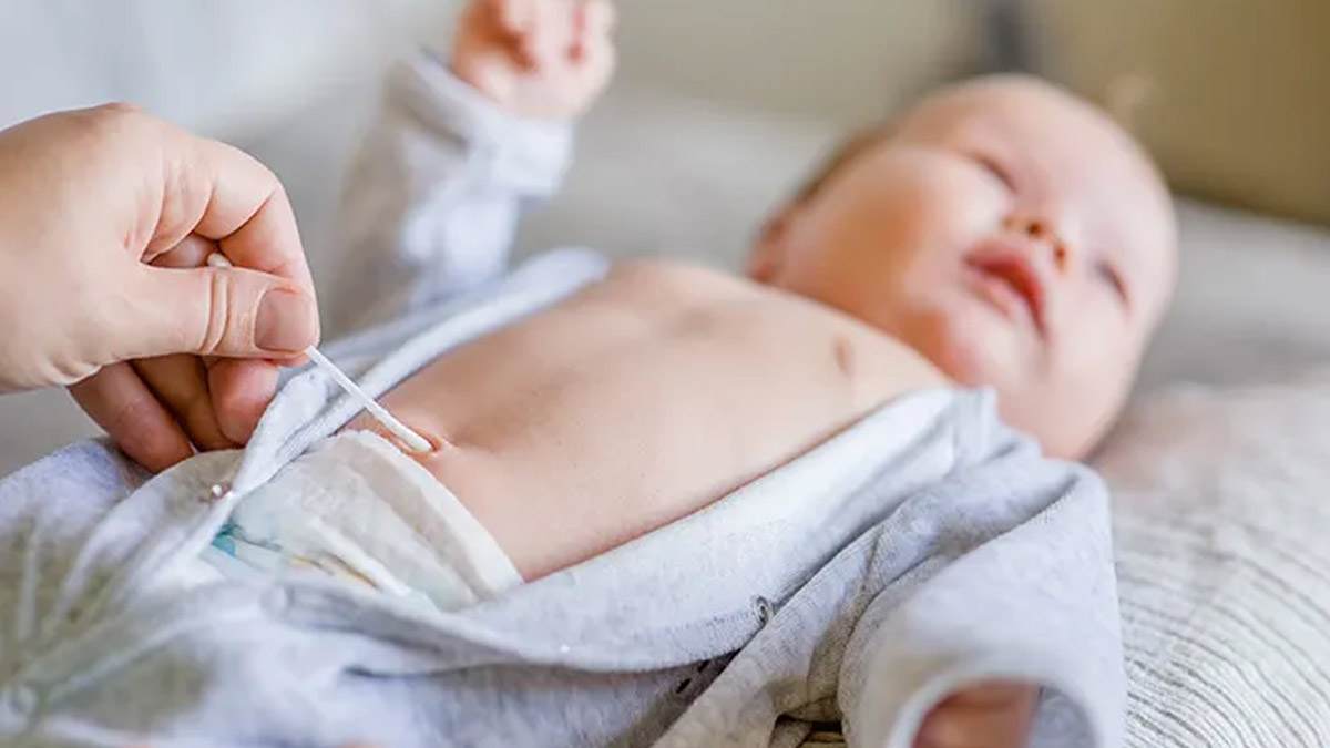 नवजात शिशु की नाभि से तरल पदार्थ क्यों निकलता है? जाने डॉक्टर से 