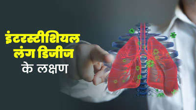 धूल और धुआं जैसे प्रदूषकों के कारण हो सकती है इंटरस्टीशियल लंग डिजीज, जानें लक्षण और बचाव