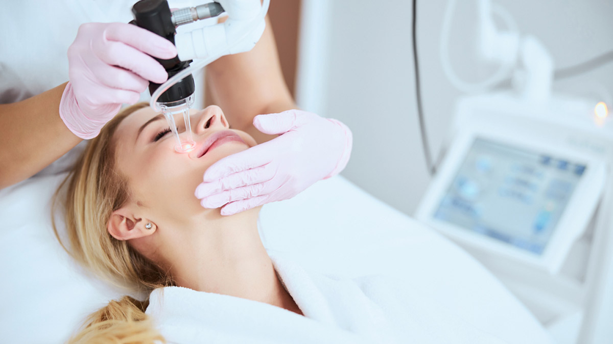 Fractional CO2 Laser Treatment For Acne Scarring: Expert Explains The Procedure, Benefits, And Risk Factors | OnlyMyHealth