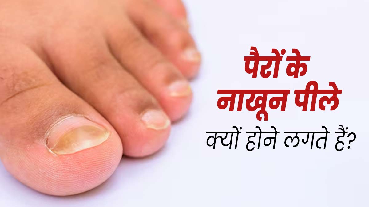 पैरों के नाखून पीले क्यों होने लगते हैं? डॉक्टर से समझें