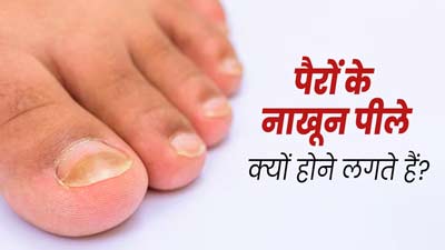 पैरों के नाखून पीले क्यों होने लगते हैं? डॉक्टर से समझें