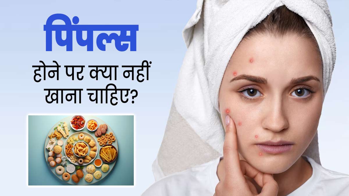 पिंपल्स होने पर क्या नहीं खाना चाहिए? जानें डाइटिशियन से