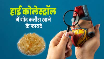 हाई कोलेस्ट्रॉल की समस्या में करें गोंद कतीरा का सेवन, मिलेंगे जबरदस्त फायदे