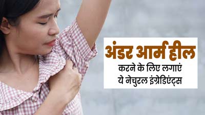 टाइट कपड़े पहनने से छिल गई है अंडरआर्म की स्किन, तो राहत पाने के लिए लगाएं ये 5 चीजें