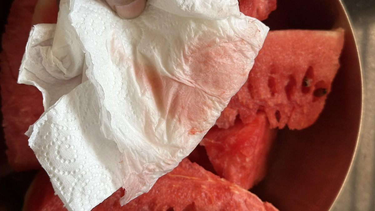 Netizens Find Watermelons Adulterated By Artificial Colours: Here Are FSSAI Guidelines To Check Contamination