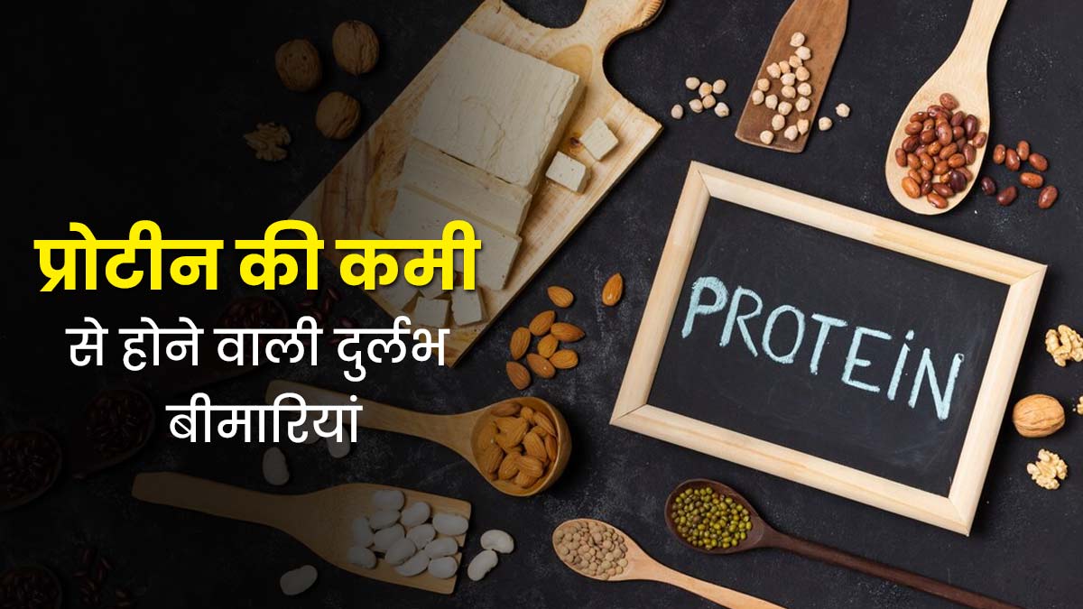 प्रोटीन की कमी की वजह से हो सकती हैं ये 5 दुर्लभ बीमारियां, डॉक्टर से जानें इनके बारे में