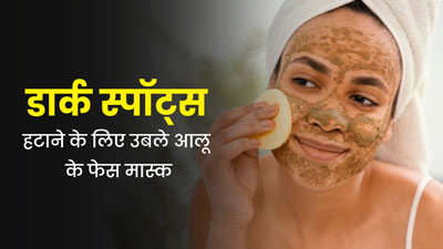 डार्क स्पॉट्स हटाने के लिए लगाएं उबले आलू के ये 5 फेस मास्क, जानें बनाने का तरीका 
