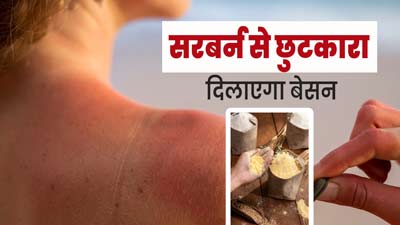 गर्मियों में सनबर्न से छुटकारा दिलाएगा बेसन, इन 2 तरीकों से करें इस्तेमाल