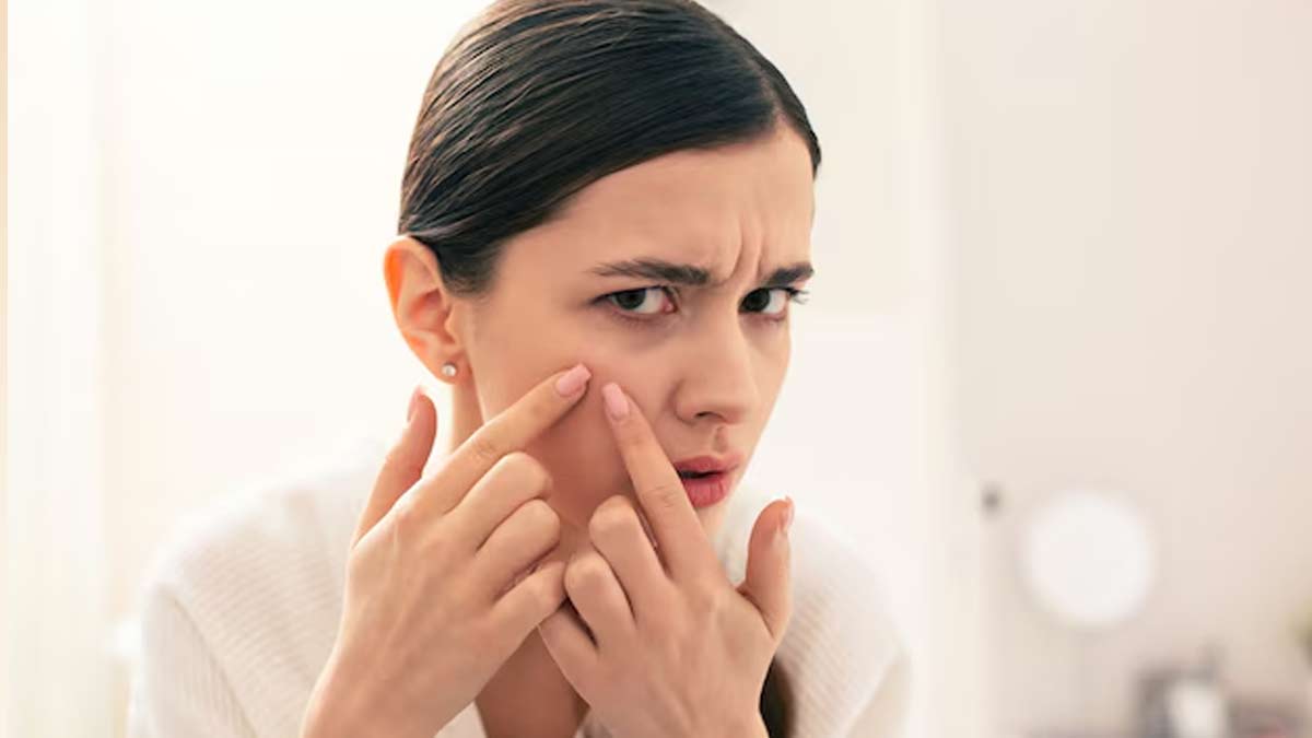 Prevent Skin Breaking Out During Summer