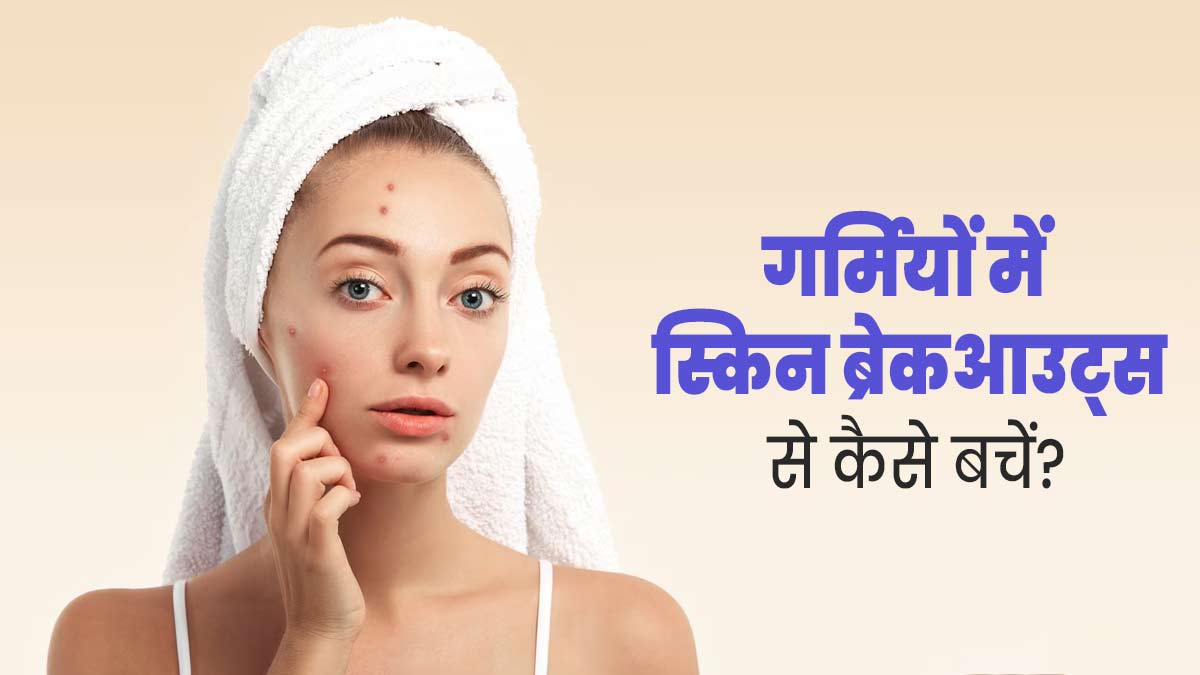 गर्मियों में स्किन ब्रेकआउट्स के कारण बढ़ जाती हैं ये समस्याएं, जानें बचाव के उपाय