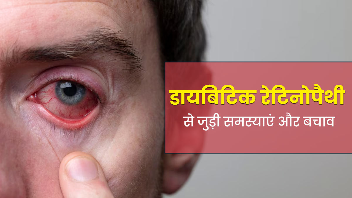 डायबिटिक रेटिनोपैथी के कारण आंखों में क्या समस्याएं हो सकती हैं? डॉक्टर से जानें बचाव के तरीके 