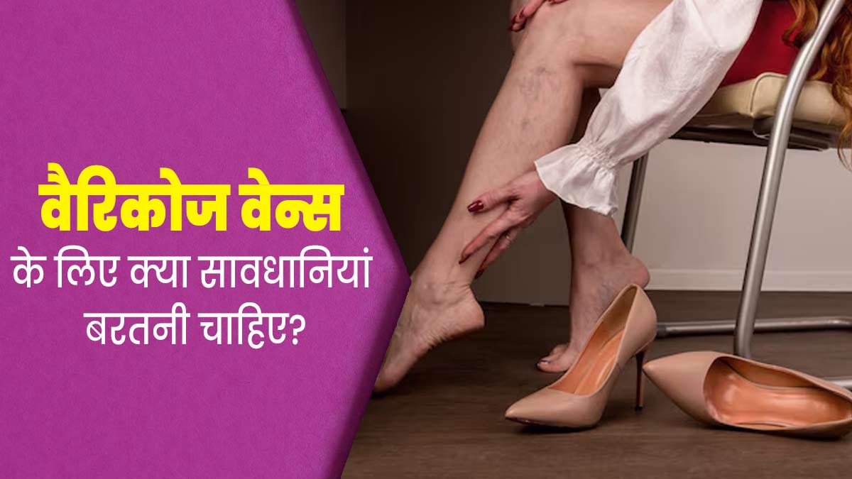 वैरिकोज वेन्स (उभरी नीली नसों) की समस्या से जूझ रहे हैं तो बरतें ये सावधानियां, नहीं बढ़ेगी दिक्कत