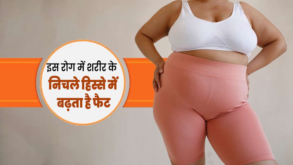 शरीर के निचले हिस्से में फैट बढ़ना हो सकता है लिपिडेमा का संकेत, जानें इसके कारण और लक्षण