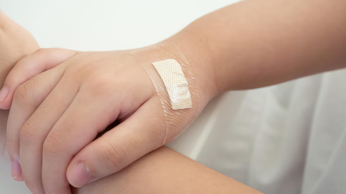 What is Silicone Scar Tape in Hindi