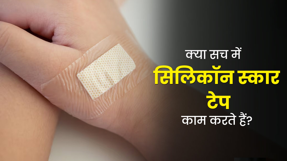 क्या सच में सिलिकॉन स्कार टेप से ठीक हो सकते हैं दाग-धब्बे और रिंकल्स, जानें एक्सपर्ट से