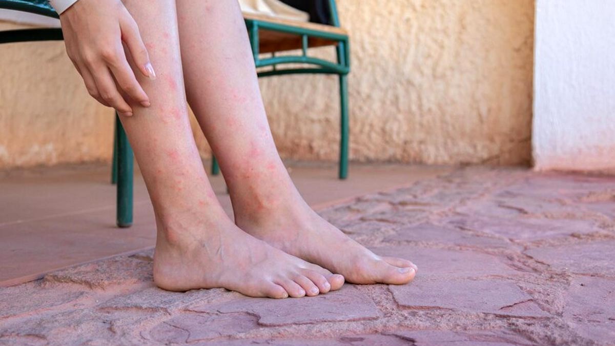Not Everyone With Flat Feet Experience Pain And Other Myths About Flat Feet Debunked