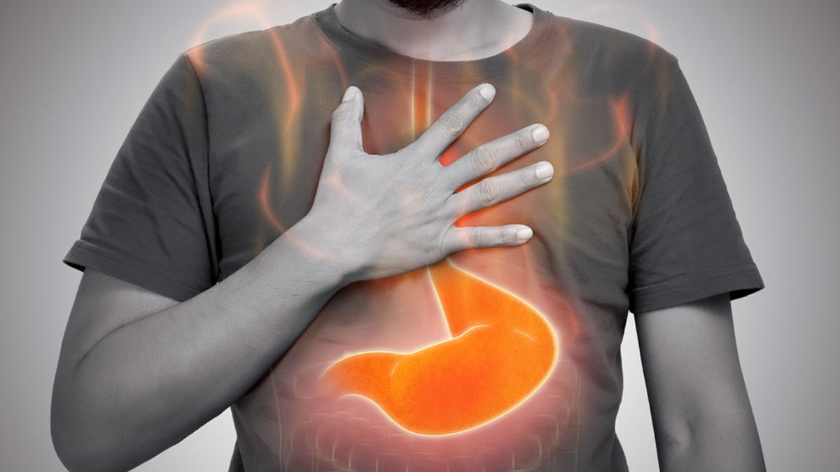 Can Acid Reflux Run In Families? Know From A Gastroenterologist