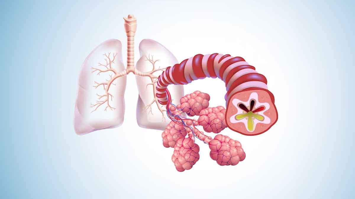 Impact Of Too Much Sugar On Lung Health: Read On 