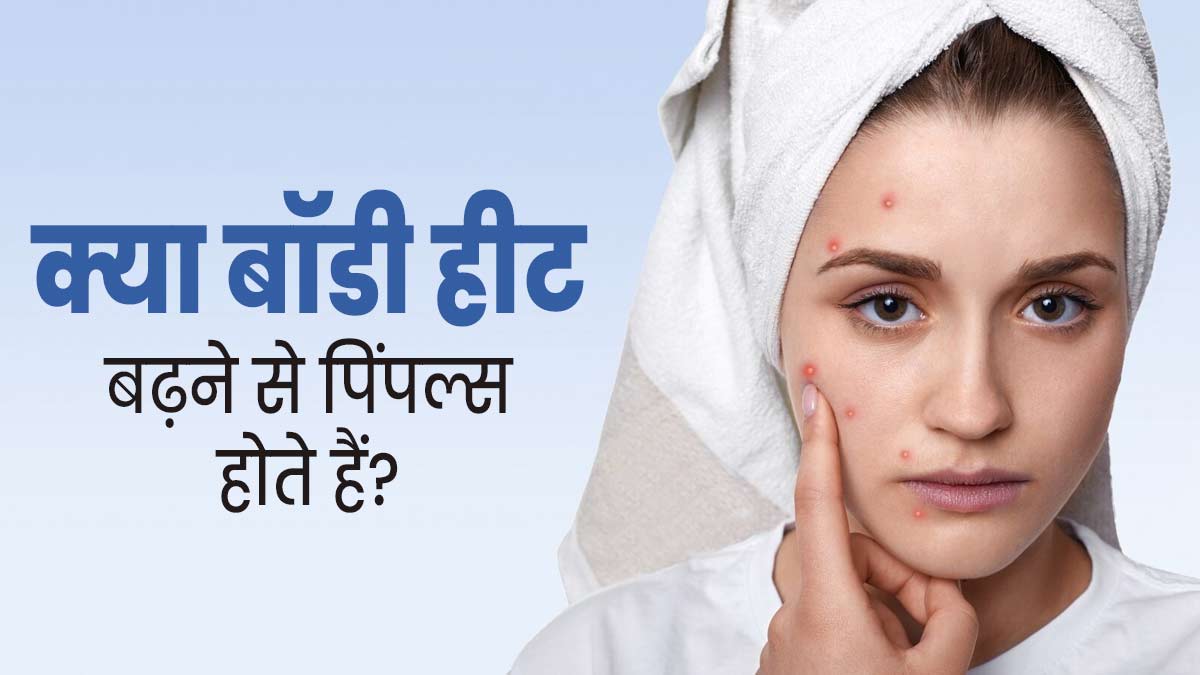 क्या शरीर में गर्मी बढ़ने की वजह से पिंपल्स होते हैं? एक्सपर्ट से जानें
