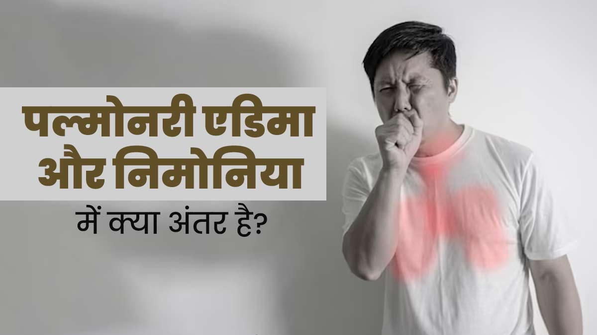 पल्मोनरी एडिमा और निमोनिया में क्या अंतर है? जानें लक्षण और बचाव