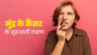 क्या तंबाकू खाने वालों और न खाने वालों में मुंह के कैंसर के शुरुआती लक्षण अलग होते हैं? जानें डॉक्टर से