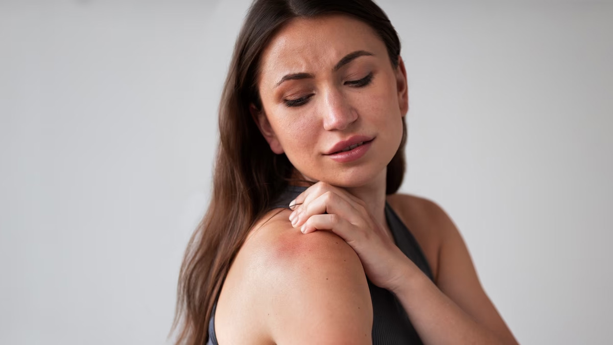 Suffering From Heat Rash? How To Spot It And What To Do | OnlyMyHealth