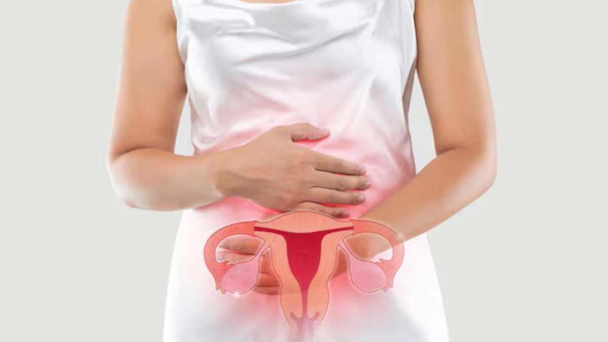 PCOS