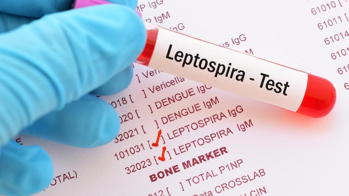 केरल में Leptospirosis के कारण गई 41 लोगों की जान, जानें इसके लक्षण और बचाव के तरीके 