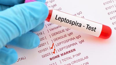 केरल में Leptospirosis के कारण गई 41 लोगों की जान, जानें इसके लक्षण और बचाव के तरीके 