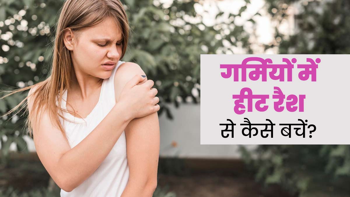 गर्मियों में हीट रैशेज से परेशान हैं तो अपनाएं ये 5 टिप्स, दूर होगी समस्या