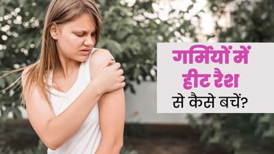 गर्मियों में हीट रैशेज से परेशान हैं तो अपनाएं ये 5 टिप्स, दूर होगी समस्या