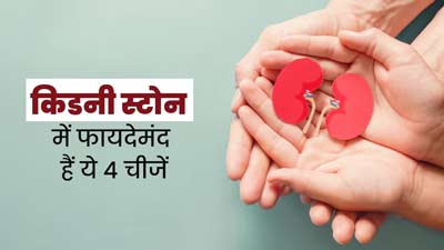 किडनी स्टोन में फायदेमंद हैं ये 4 चीजें, आयुर्वेदाचार्य से जानें सेवन का तरीका