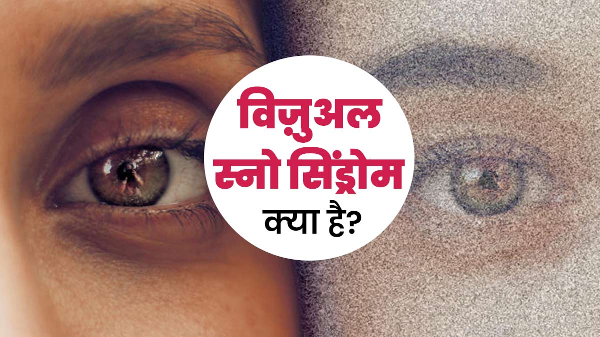 विजुअल स्नो सिंड्रोम होने पर दिखाई देते हैं टिमटिमाते सफेद या रंगीन बिंदु, जानें क्‍या है आंखों की यह समस्या? 
