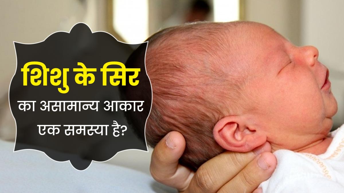 क्‍या श‍िशु के स‍िर का असामान्‍य आकार च‍िंता का व‍िषय है? डॉक्‍टर से जानें 