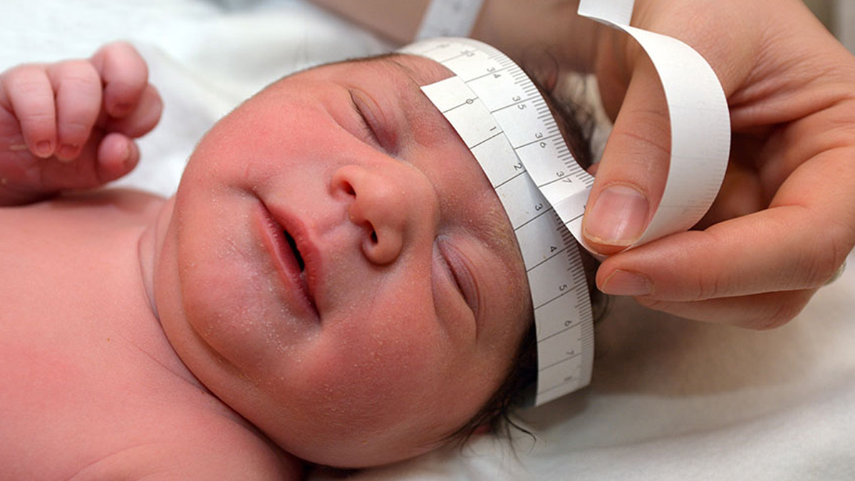 abnormal baby head causes