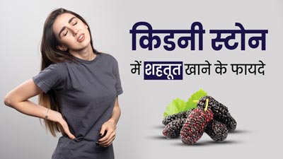 किडनी स्टोन की समस्या में खाएं शहतूत, मिलेंगे जबरदस्त फायदे