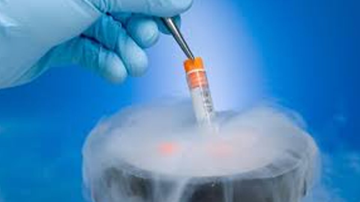 Egg Freezing