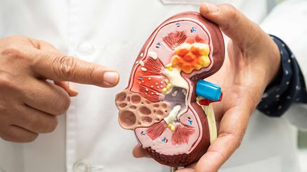 Myths And Facts About Kidney Diseases In Hindi