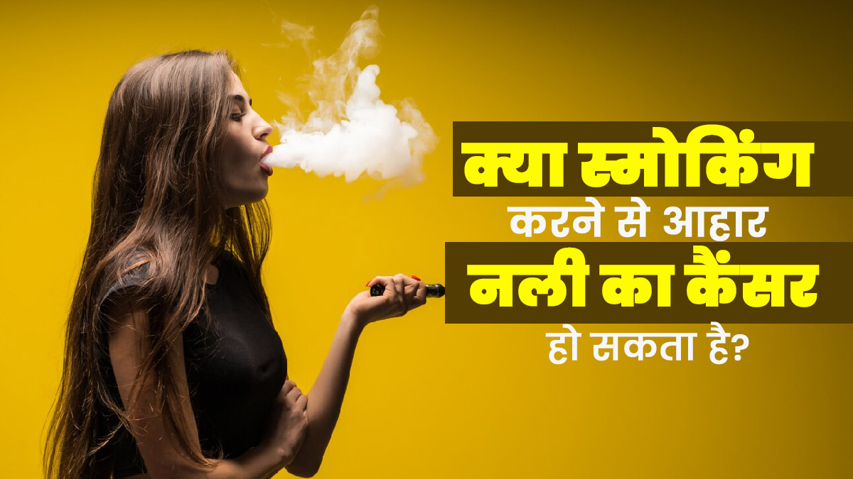 World No Tobacco Day: क्या स्मोकिंग करने से आहार नली का कैंसर हो सकता है? डॉक्टर से जानें 