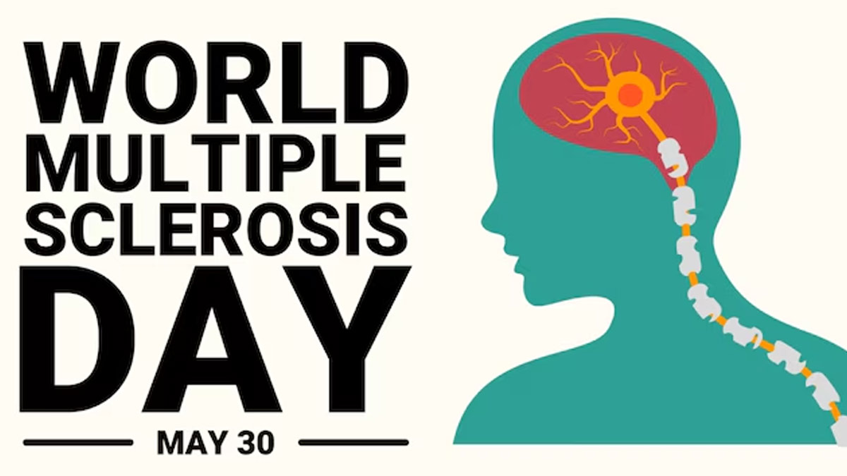 World Multiple Sclerosis Day 2024: क्यों मनाते हैं विश्व मल्टीपल स्केलेरोसिस दिवस? जानें इतिहास, महत्व और थीम