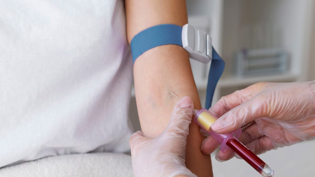 What is The Normal Range of Serum Bilirubin in Hindi