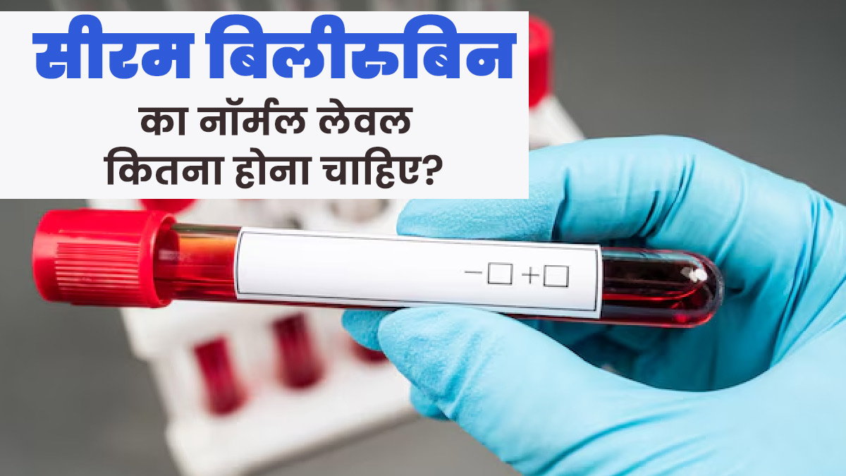 ब्लड में सीरम बिलीरुबिन का नॉर्मल लेवल कितना होना चाहिए? जानें बढ़ने के नुकसान