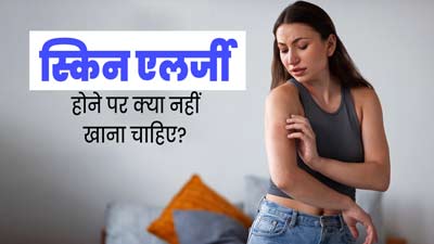 स्किन एलर्जी होने पर किन चीजों का सेवन नहीं करना चाहिए? जानें एक्सपर्ट से 
