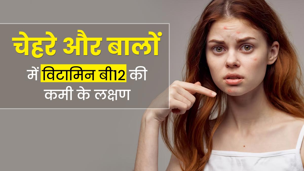चेहरे और बालों पर नजर आने वाले ये 5 लक्षण हो सकते हैं विटामिन बी12 की कमी का संकेत, न करें नजरअंदाज