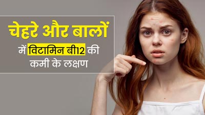 चेहरे और बालों पर नजर आने वाले ये 5 लक्षण हो सकते हैं विटामिन बी12 की कमी का संकेत, न करें नजरअंदाज