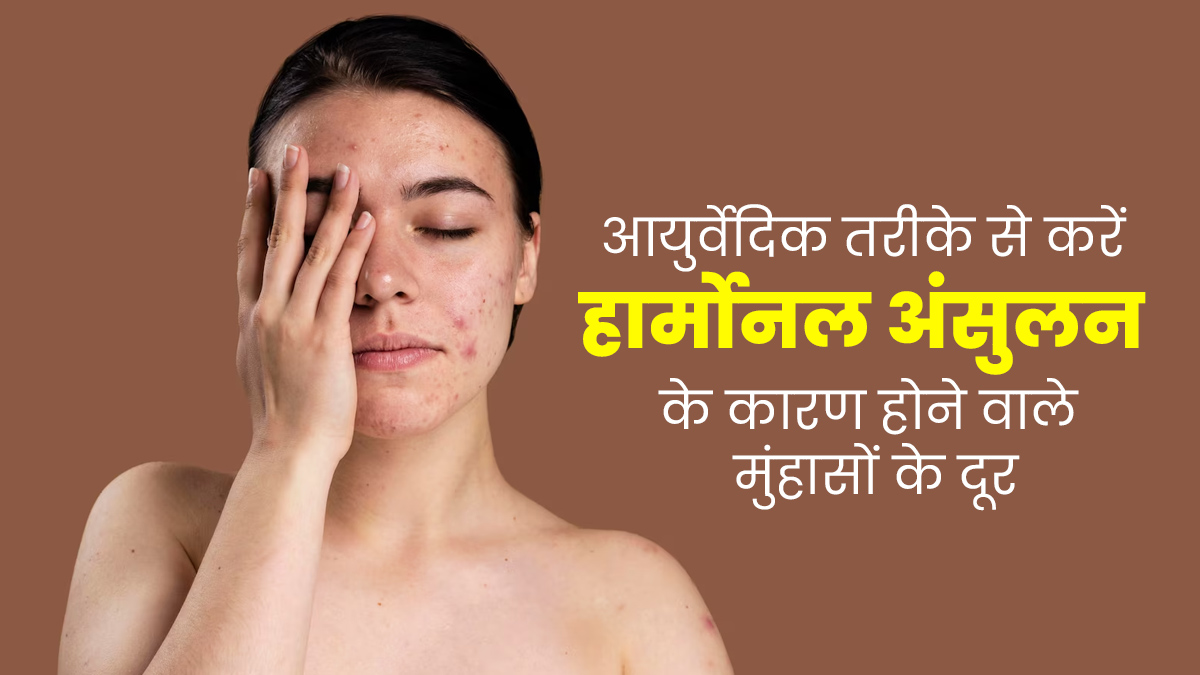 हार्मोनल अंसुलन के कारण होने वाले मुंहासों को दूर करने के आयुर्वेदिक इलाज, तुरंत मिलेगी राहत