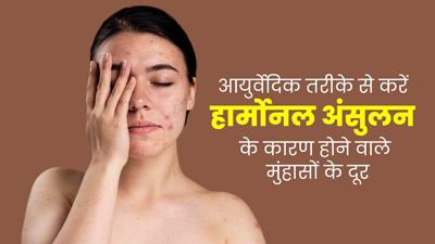 हार्मोनल अंसुलन के कारण होने वाले मुंहासों को दूर करने के आयुर्वेदिक इलाज, तुरंत मिलेगी राहत