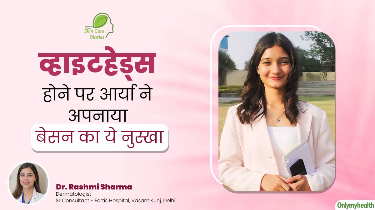 Skin Care Diaries: व्हाइटहेड्स होने पर आर्या पांडे ने अपनाया बेसन का ये नुस्खा, कुछ दिनों में दूर हो गई समस्या