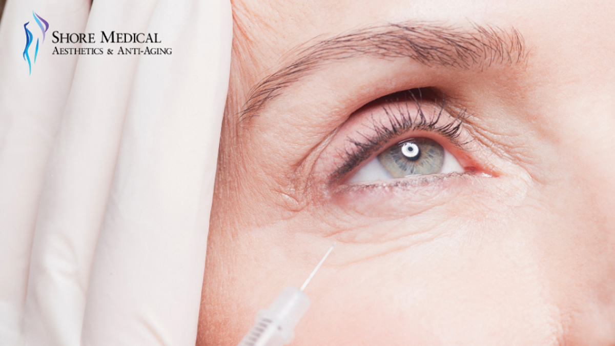 Where Can I Find the Best Botox Near Me for Under Eye Wrinkles?
